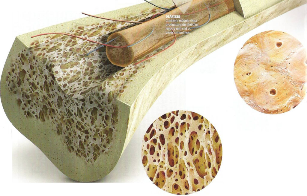 Gráfico de las travéculas del hueso y su tejido esponjoso