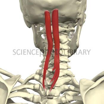 Músculo erector de la espina