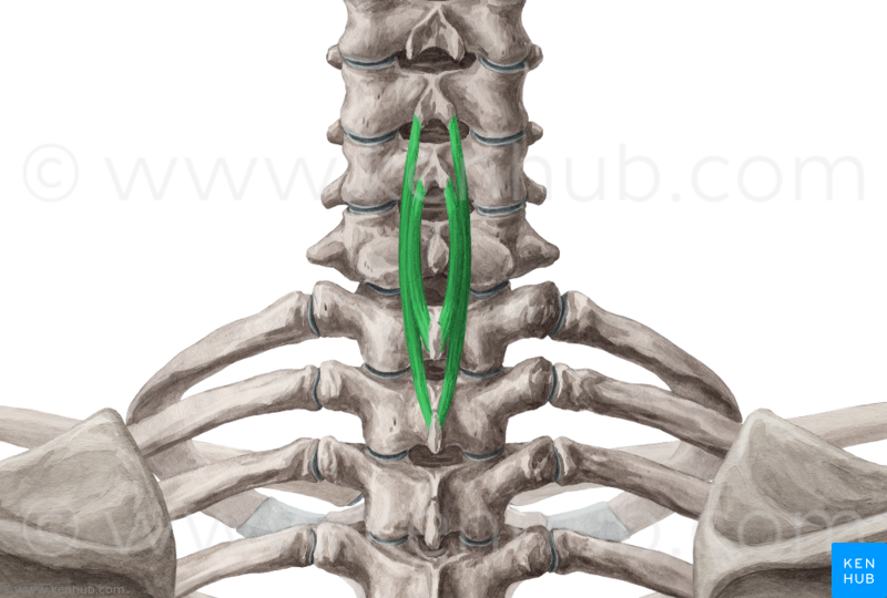 Músculo espinal del cuello